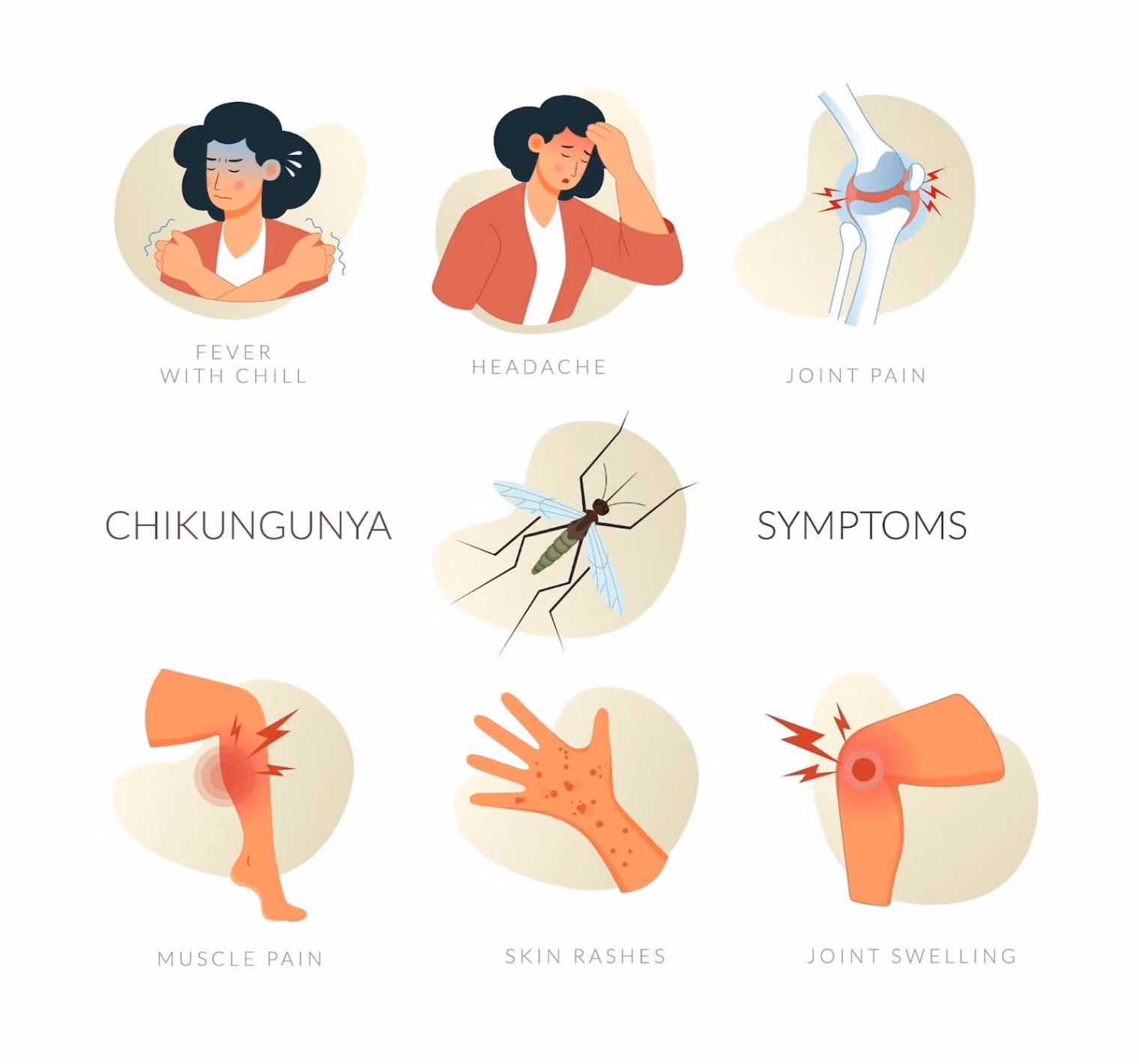 Chikungunya Virus In China: Essential Safety Guide For Travelers 5 Chikungunya Symptoms